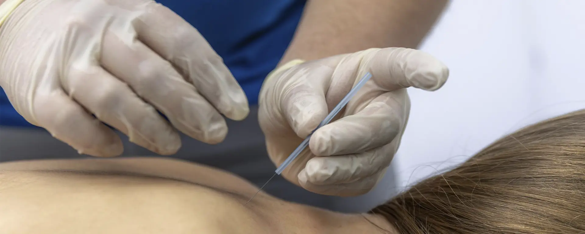 Tratamiento de punción seca - Albor Fisioterapia